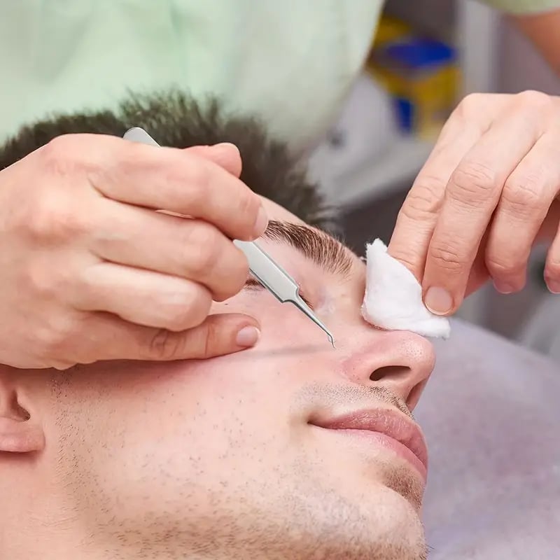 ClearSkin | Vous permet d'éliminer facilement les points noirs et l'acné les plus tenaces