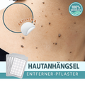 Éliminateur de Mollettes | Patch pour l'élimination des étiquettes | Sans douleur & Naturel | PatchEase