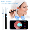 Votre compagnon intelligent de soins auriculaires avec caméra – OorSpa™