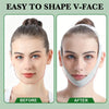 V-Fit Bande de Lifting du Visage – Pour un Contour Plus Svelte et Jeune