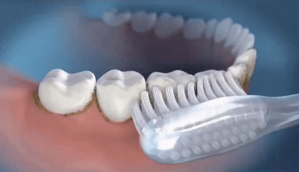 Waterflosser - Fil dentaire sans douleur | Trois options de couleur