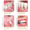 Waterflosser - Fil dentaire sans douleur | Trois options de couleur