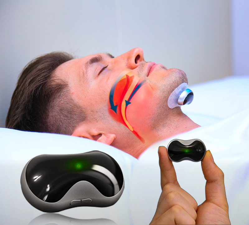SnoozeFix Appareil Anti-Ronflement - Améliorez votre Sommeil avec une Technologie Confortable